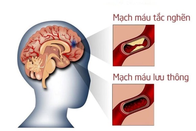 Thảo dược mới hỗ trợ phòng chống huyết ứ- Ảnh 1.