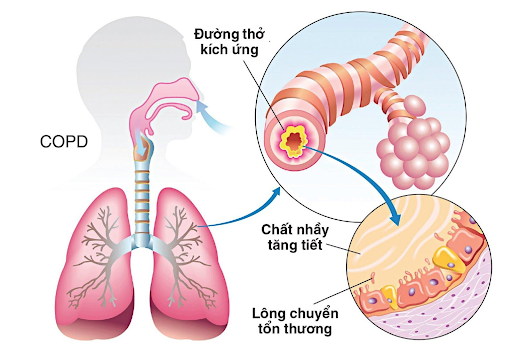 Bài thuốc từ cây phật thủ- Ảnh 2.