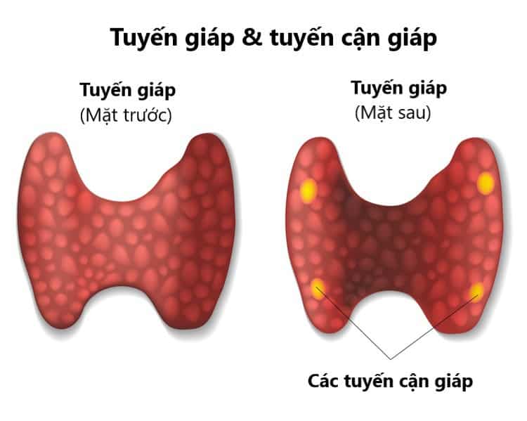 Người bệnh suy tuyến cận giáp cần làm gì để nâng cao chất lượng cuộc sống?- Ảnh 1.