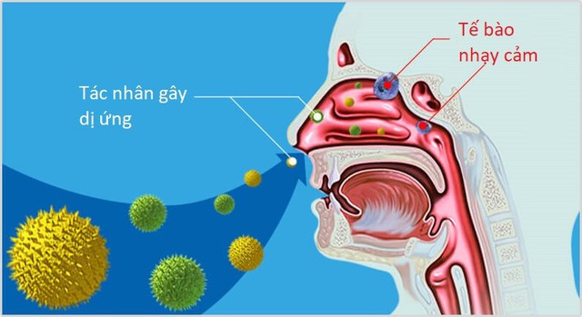 Cách dùng thuốc nhỏ mũi chứa corticoid an toàn- Ảnh 1.