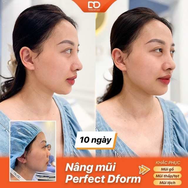 Bí quyết cho nhan sắc rạng ngời - Làm đẹp toàn diện cùng Thẩm mỹ DrD- Ảnh 1.