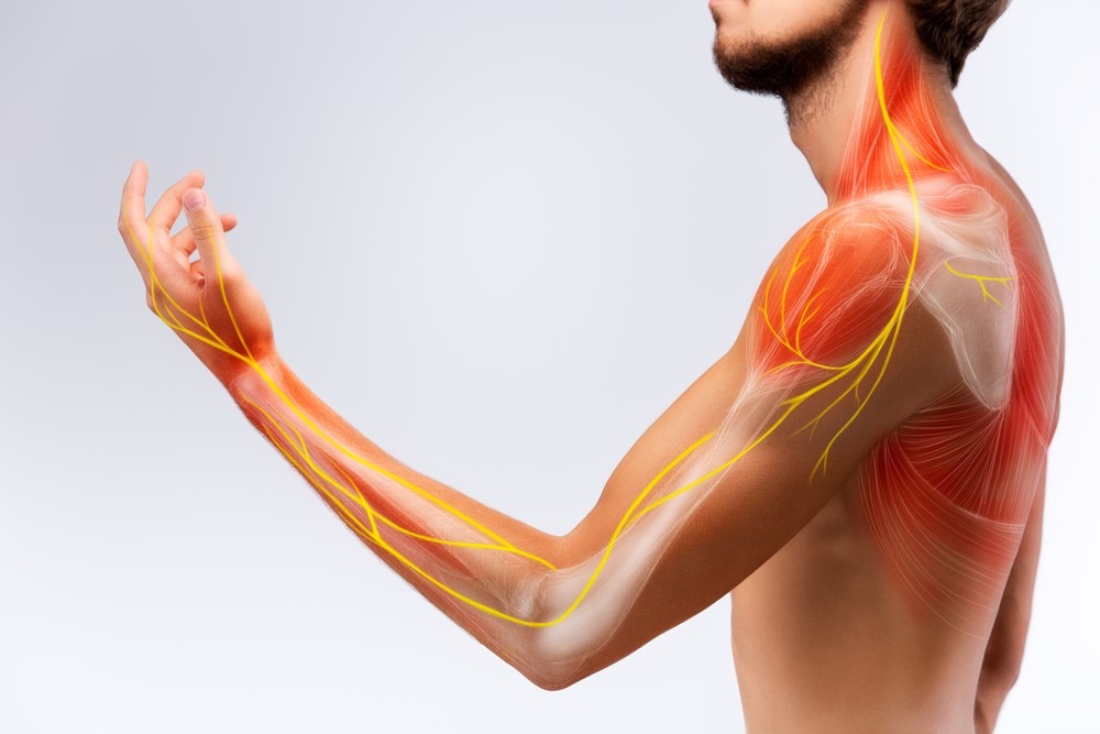 Tê tay, chân... cảnh giác với viêm đa dây thần kinh- Ảnh 1. Tê tay, chân... cảnh giác với viêm đa dây thần kinh- Ảnh 1.