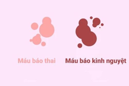 Phân biệt máu báo mang thai và ra máu kinh nguyệt- Ảnh 1.