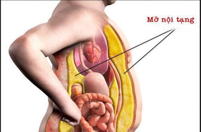 Mỡ nội tạng có hại thế nào với sức khỏe?- Ảnh 1.