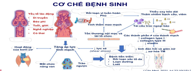 Tĩnh mạch chi dưới có thể gây ra những biến chứng nguy hiểm gì?- Ảnh 1.