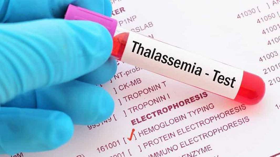 Thalassemia (tan máu bẩm sinh): Biểu hiện, nguyên nhân, điều trị và phòng bệnh- Ảnh 1.