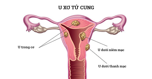 Khi nào chảy máu âm đạo là nguy hiểm?- Ảnh 1.