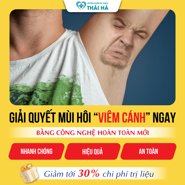 Địa chỉ chữa hôi nách ở đâu tốt tại Hà Nội, chi phí phù hợp- Ảnh 1.