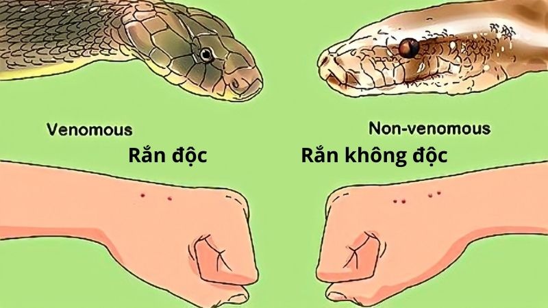 Phân biệt rắn độc và rắn không độc cắn, cách sơ cứu ban đầu đúng nhất- Ảnh 2.