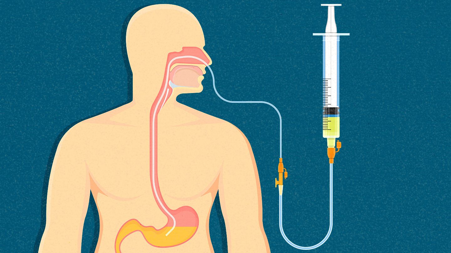 Chăm sóc dinh dưỡng cho người bị uốn ván- Ảnh 2.