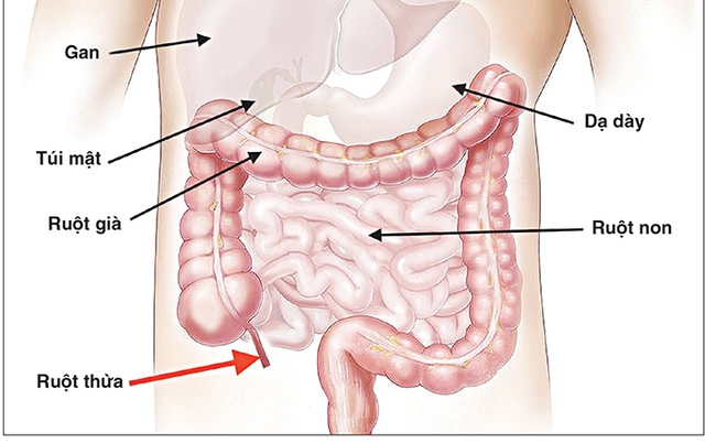 Bệnh viêm ruột thường xảy ra ở người trưởng thành, tuy nhiên gần đây có nhiều cảnh báo về chứng bệnh viêm ruột, trong đó trẻ em cũng là đối tượng nguy cơ của bệnh.