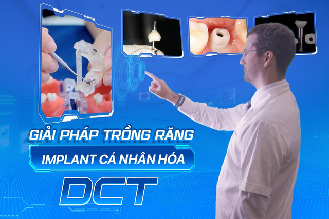 Giải pháp trồng răng implant cá nhân hóa DCT - Xu hướng trồng răng thế kỷ XXI- Ảnh 1.