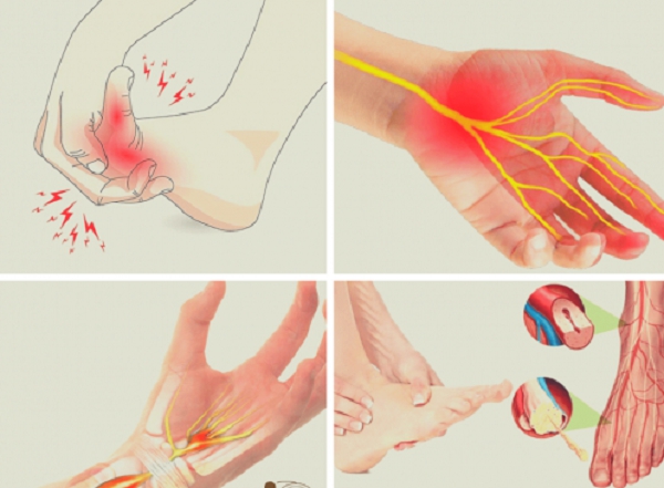 7 lý do gây tê bì tay chân cần biết- Ảnh 1.