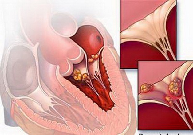 Câu hỏi thường gặp liên quan đến thấp tim- Ảnh 1.