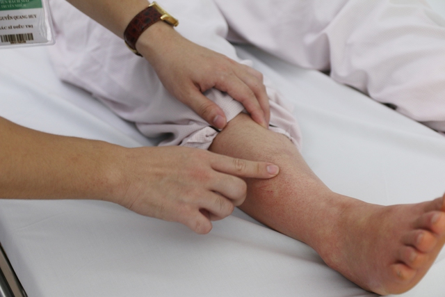 Những câu hỏi thường gặp về sốt xuất huyết- Ảnh 1. Những câu hỏi thường gặp về sốt xuất huyết- Ảnh 1.