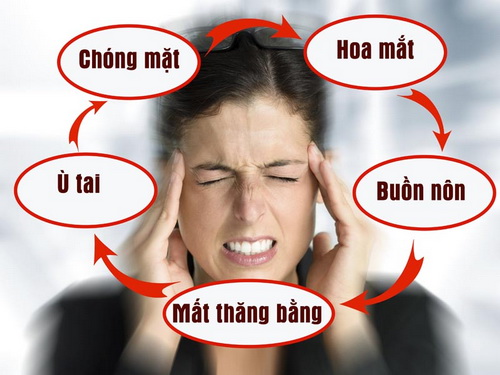 Rối loạn tiền đình ở người trẻ phải làm gì?- Ảnh 1.