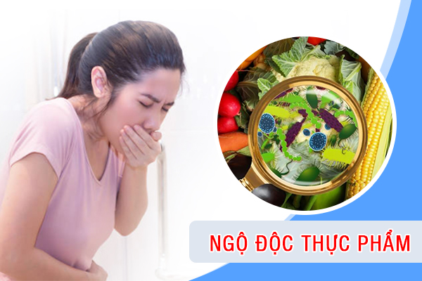 Các bài thuốc sơ cứu người bị ngộ độc thực phẩm đơn giản tại nhà- Ảnh 1.