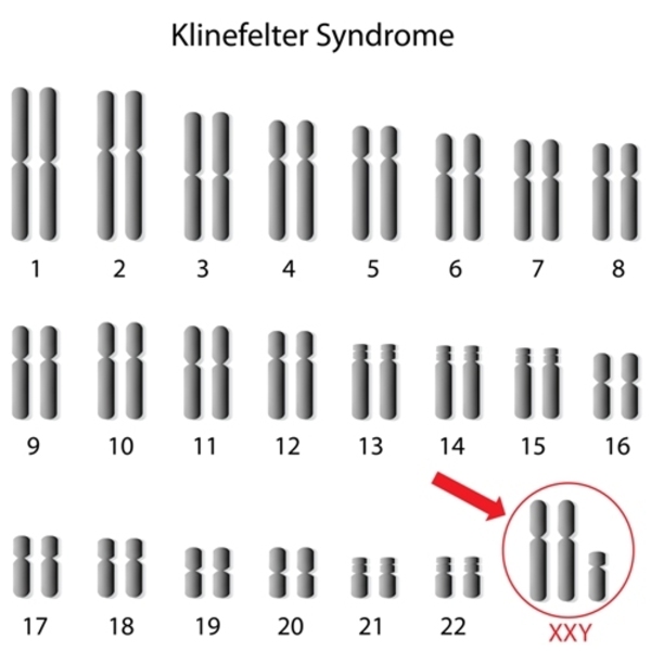 Thuốc điều trị Hội chứng Klinefelter- Ảnh 2.