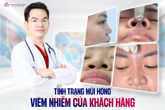 Lấy lại vẻ đẹp hoàn mỹ sau 2 lần nâng mũi thất bại- Ảnh 1.