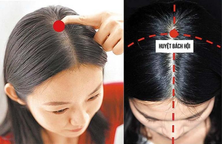 Xoa bóp bấm huyệt phòng và trị rối loạn tiền đình- Ảnh 1. Xoa bóp bấm huyệt phòng và trị rối loạn tiền đình- Ảnh 1.