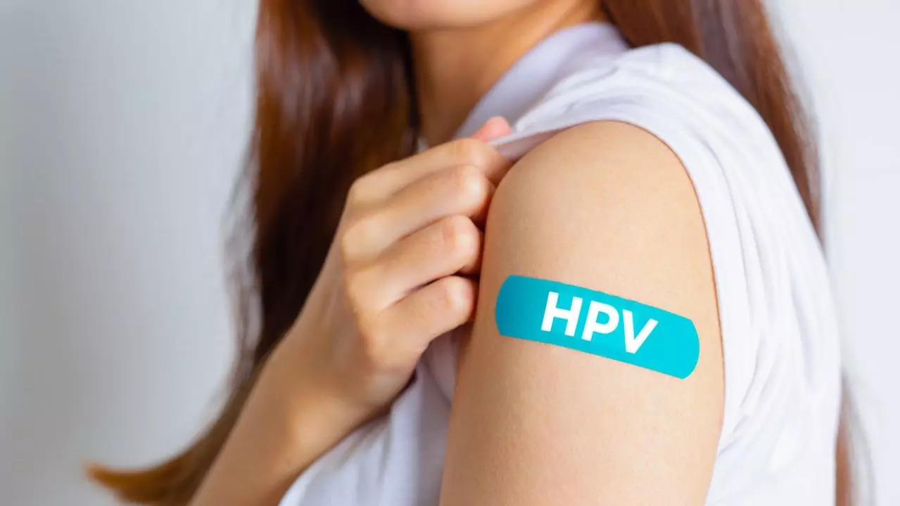 Loại ung thư nào có thể phòng ngừa bằng vaccine?- Ảnh 1. Vắc-xin HPV