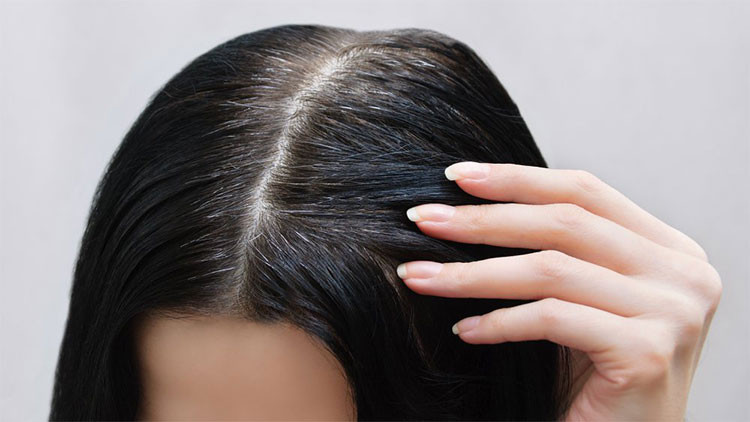 Nên ăn gì để làm đen tóc?- Ảnh 1. Nên ăn gì để làm đen tóc?- Ảnh 1.
