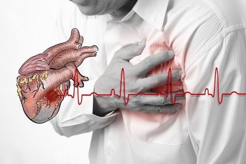 Biến chứng nguy hiểm của nhồi máu cơ tim- Ảnh 1. Biến chứng nguy hiểm của nhồi máu cơ tim- Ảnh 1.