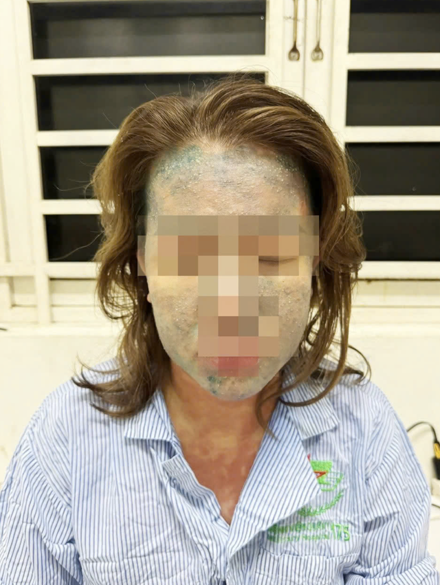Một phụ nữ nguy kịch sau khi dùng thuốc giảm cân thải độc, collagen không rõ nguồn gốc- Ảnh 1. Một phụ nữ nguy kịch sau khi dùng thuốc giảm cân thải độc, collagen không rõ nguồn gốc- Ảnh 1.