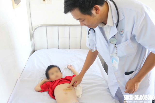 Búi tóc nặng gần nửa cân nằm trong bụng bé trai 5 tuổi- Ảnh 1. Búi tóc nặng gần nửa cân nằm trong bụng bé trai 5 tuổi- Ảnh 1.