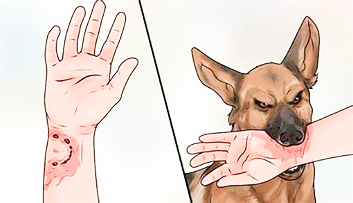 Bệnh dại là bệnh lây truyền từ động vật sang người nguy hiểm do virus dại gây ra, thường tác động lên hệ thần kinh, tỷ lệ tử vong rất cao. Bệnh dại là bệnh lây truyền từ động vật sang người nguy hiểm do virus dại gây ra, thường tác động lên hệ thần kinh, tỷ lệ tử vong rất cao.