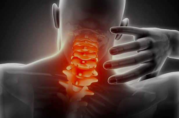 Đau cổ vai gáy có thể bị liệt nếu điều trị sai cách- Ảnh 1. Đau cổ vai gáy có thể bị liệt nếu điều trị sai cách- Ảnh 1.