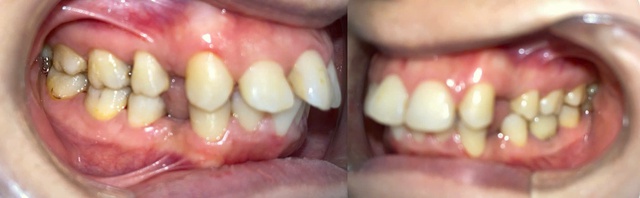 Đi tái khám, nữ sinh sững sờ khi thấy phòng khám niềng răng đã 'biến mất'- Ảnh 1. Đi tái khám, nữ sinh sững sờ khi thấy phòng khám niềng răng đã 'biến mất'- Ảnh 1.