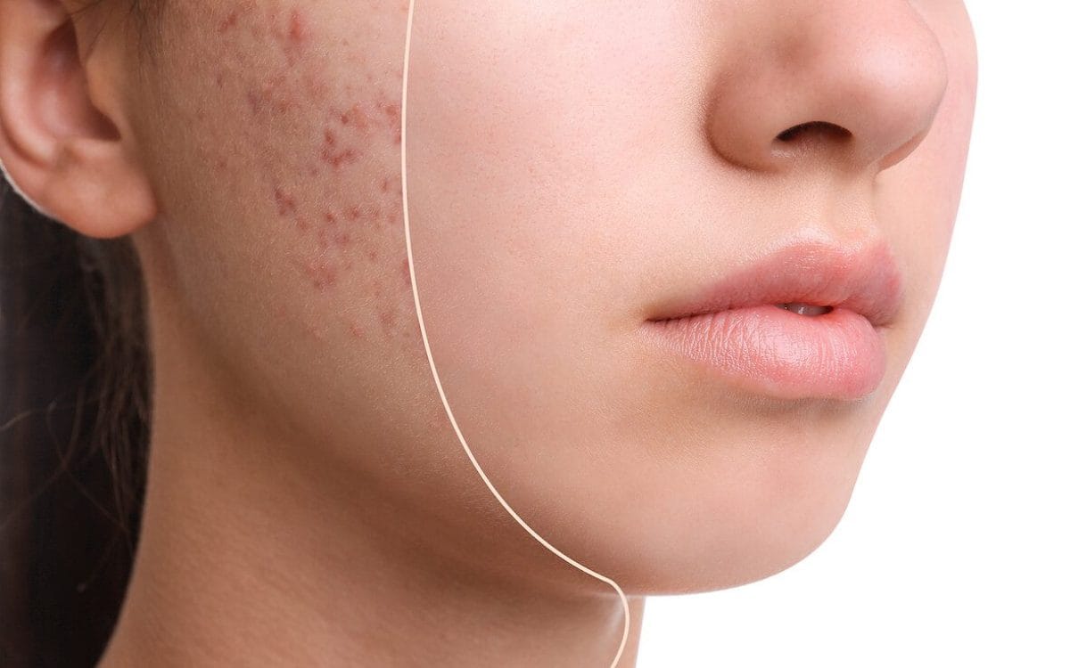 7 vấn đề về da mùa hè có thể ngăn ngừa- Ảnh 1. 7 vấn đề về da mùa hè có thể ngăn ngừa- Ảnh 1.