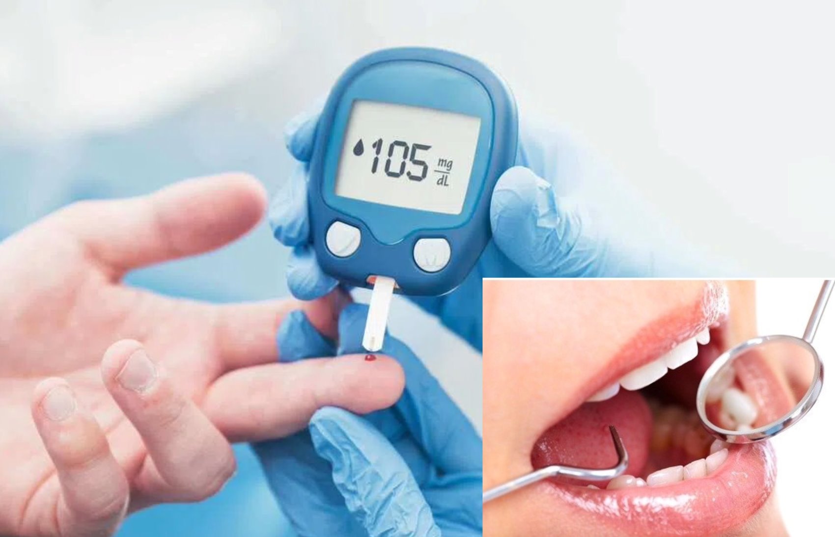 Bí quyết ngăn ngừa biến chứng răng miệng ở người bệnh tiểu đường- Ảnh 1. Bí quyết ngăn ngừa biến chứng răng miệng ở người bệnh tiểu đường- Ảnh 1.