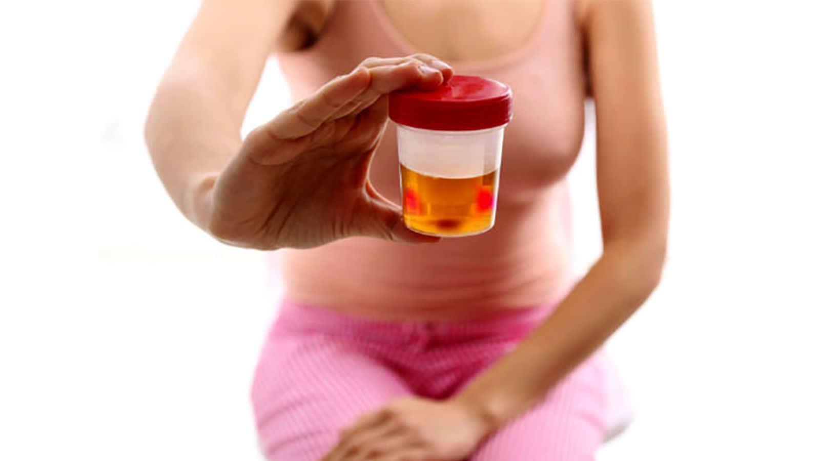 Tiểu ra máu cảnh báo bệnh gì, nguy hiểm không?- Ảnh 1. Tiểu ra máu cảnh báo bệnh gì, nguy hiểm không?- Ảnh 1.