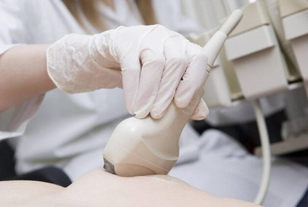 Các xét nghiệm cần làm khi có dấu hiệu nghi ngờ mắc ung thư vú- Ảnh 1. Các xét nghiệm cần làm khi có dấu hiệu nghi ngờ mắc ung thư vú- Ảnh 1.