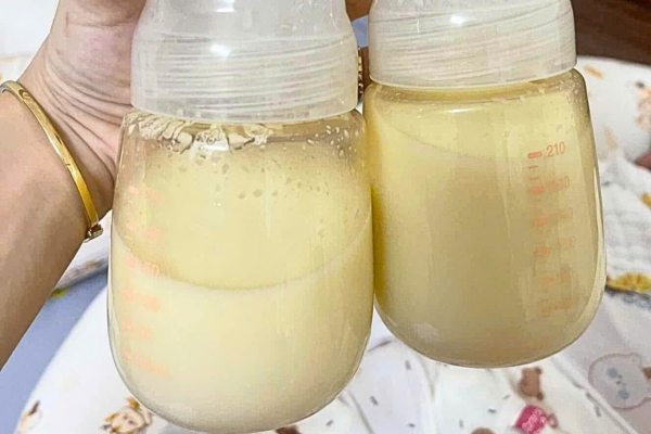 Phân biệt màu sữa mẹ an toàn và dấu hiệu cần cảnh giác- Ảnh 1. Phân biệt màu sữa mẹ an toàn và dấu hiệu cần cảnh giác- Ảnh 1.
