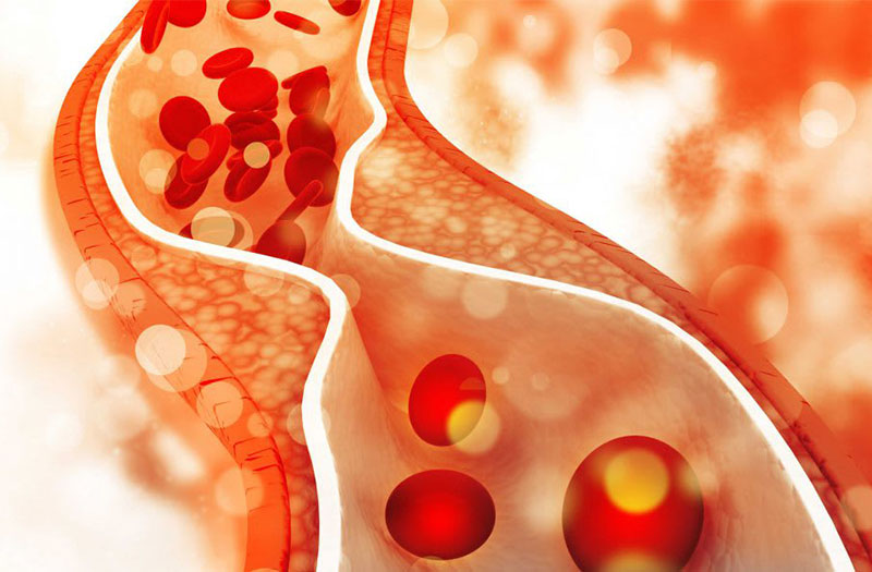 Rối loạn lipid máu ở bệnh nhân tiểu đường cần lưu ý gì?- Ảnh 2. Rối loạn lipid máu ở bệnh nhân tiểu đường cần lưu ý gì?- Ảnh 2.