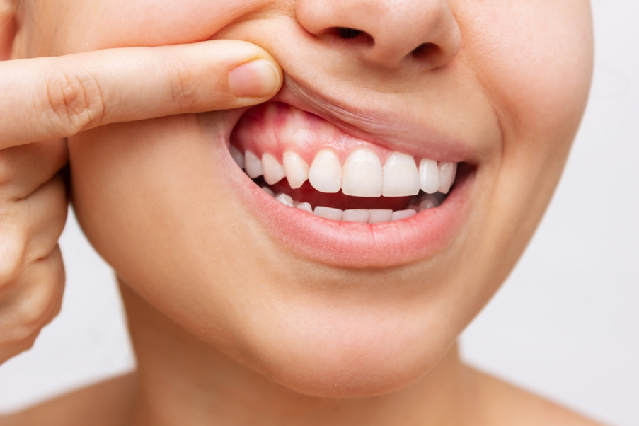 Ăn uống đồ quá nóng, quá lạnh: Kẻ thù âm thầm của răng và nướu (lợi)- Ảnh 1. Ăn uống đồ quá nóng, quá lạnh: Kẻ thù âm thầm của răng và nướu (lợi)- Ảnh 1.
