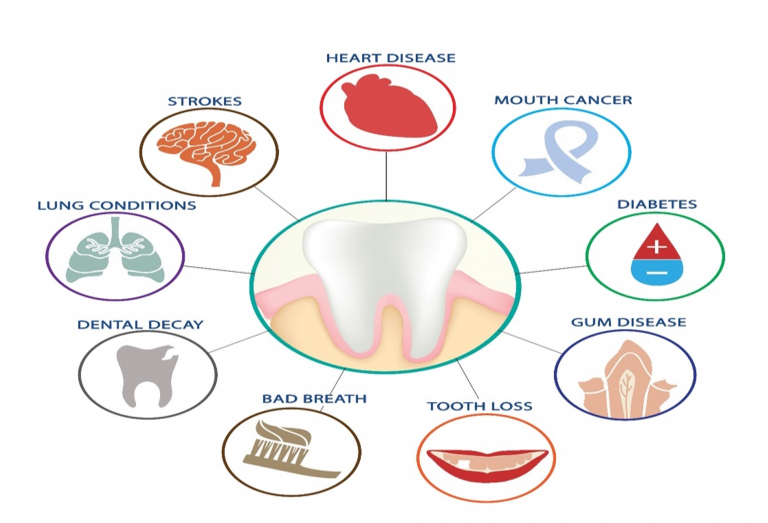 Có thể bạn chưa biết: Răng miệng khỏe - phòng bệnh toàn thân- Ảnh 1. Có thể bạn chưa biết: Răng miệng khỏe - phòng bệnh toàn thân- Ảnh 1.